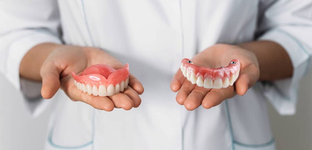 Comparing Dentures and Implants